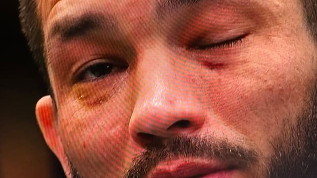 Ex-UFC Champ Calls for Major Change After Eye Poke Travesty at UFC Vegas 85